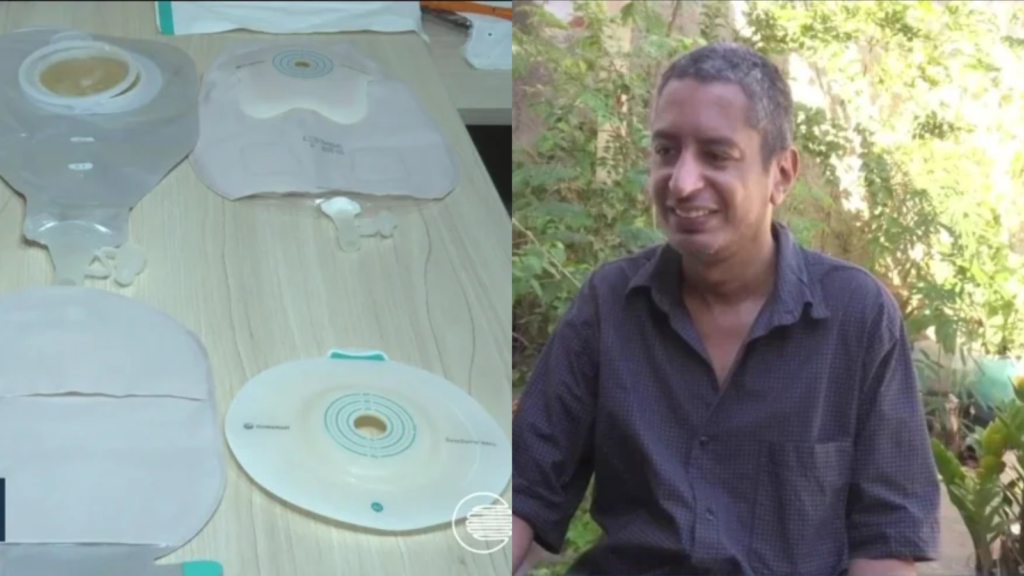 Bolsas de ostomia em Teresina: pacientes denunciam falta e má qualidade