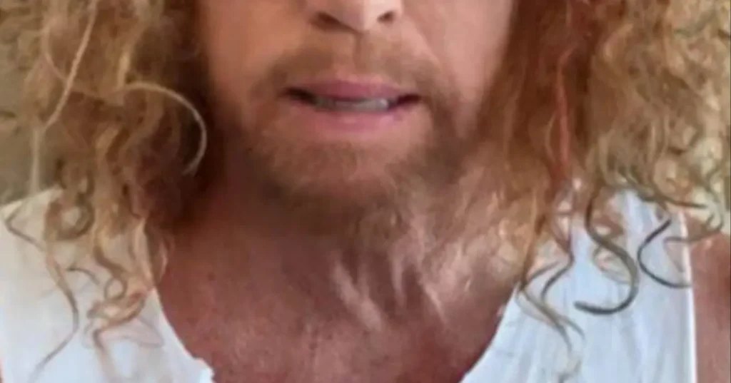 Humorista Carrot Top é hospitalizado após tentativa de suicídio em Las Vegas