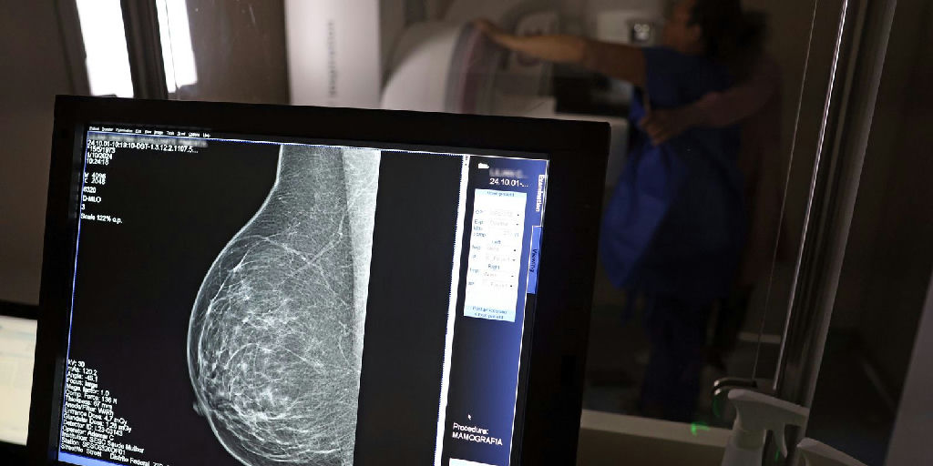 Planos de saúde passam a cobrir mamografia digital sem limite de idade