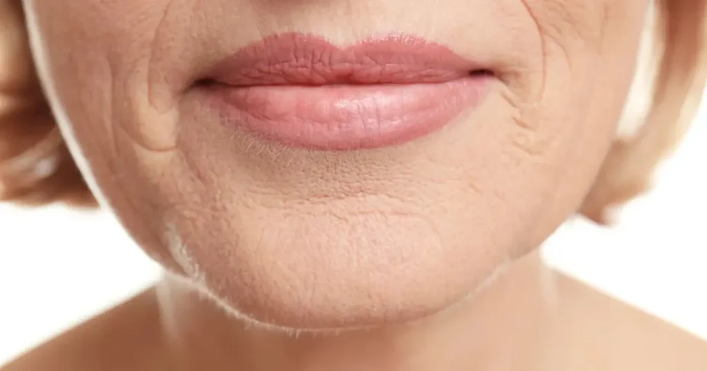 Bigode chinês: como técnicas de massagem facial podem suavizar linhas de expressão