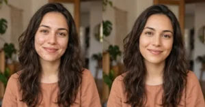 Manchas pós-acne: entenda como tratar marcas e recuperar a uniformidade da pele