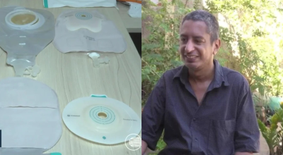 Bolsas de ostomia em Teresina: pacientes denunciam falta e má qualidade