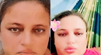 Morre terceira paciente de centro de diálise em Mossoró