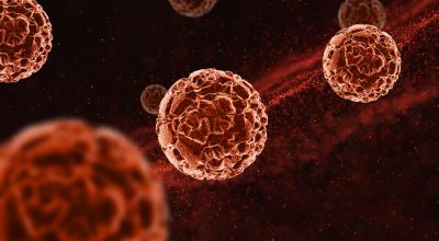 Por que homens pode desenvolver subtipo mais grave de câncer de sangue