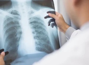Anvisa aprova novos medicamentos para tratamento de câncer de pulmão e de mama