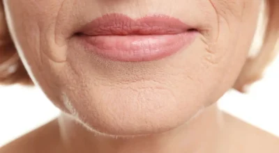 Bigode chinês: como técnicas de massagem facial podem suavizar linhas de expressão