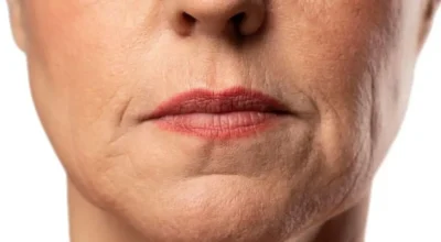 Bigode chinês: conheça três produtos coreanos que auxiliam no tratamento das linhas
