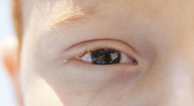 Diagnóstico precoce de baixa visão na infância é essencial para o desenvolvimento infantil
