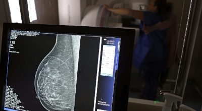 Planos de saúde passam a cobrir mamografia digital sem limite de idade