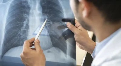 Tabagismo atinge mais jovens brasileiros entre 16 e 24 anos, aponta levantamento